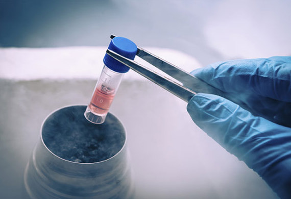 Frozen Embryo Transfer