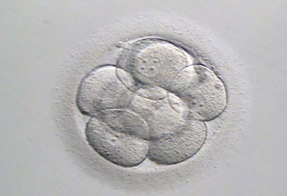 Laser Assisted Hatching
