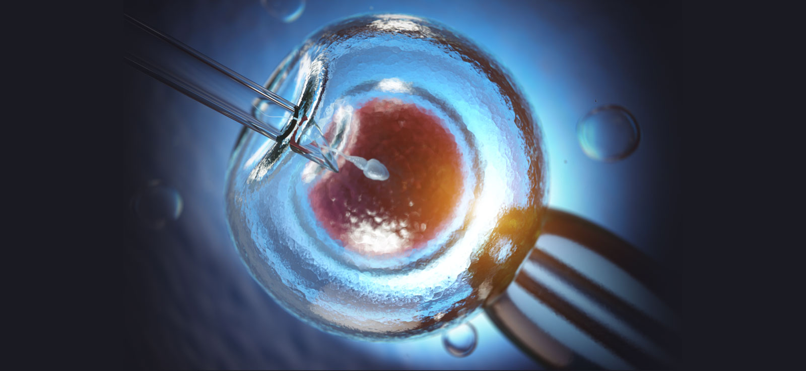 ivf