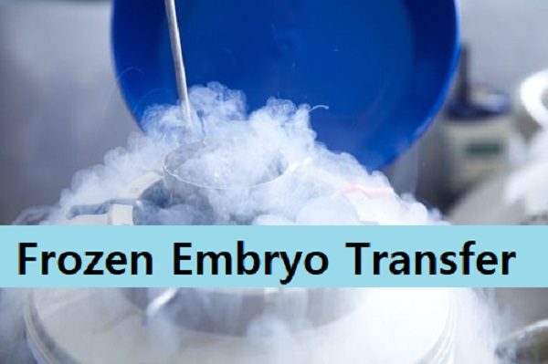 Frozen Embryo Transfer