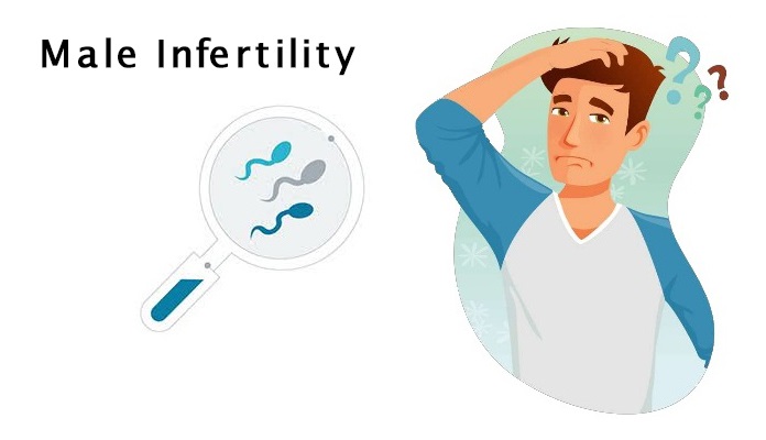 Male Infertility