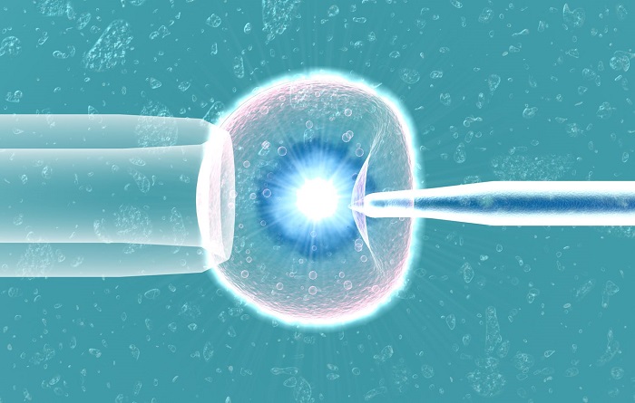 Laser Assisted Hatching