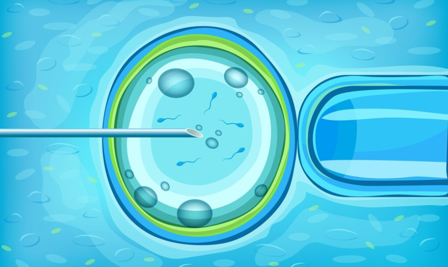 IVF Cost in New Delhi