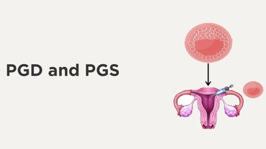 pgs pgd