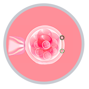 Laser-Assisted-Hatching