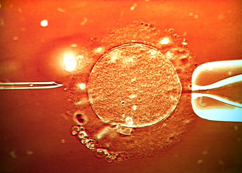 ICSI and IVF Success Rate