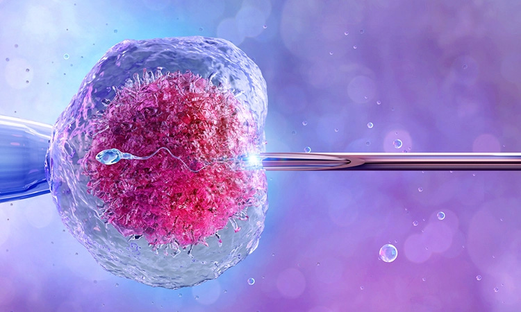 in-vitro-fertilization