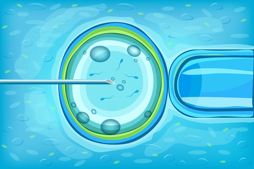 ivf treatment