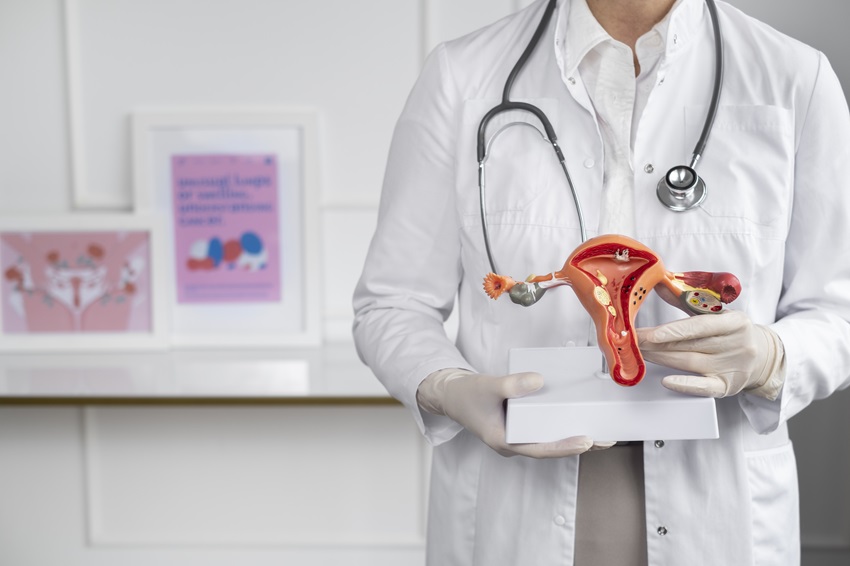 IVF and Endometriosis