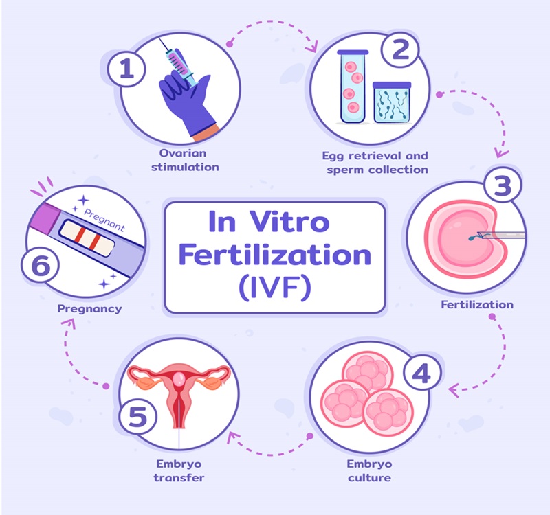 IVF Cycle